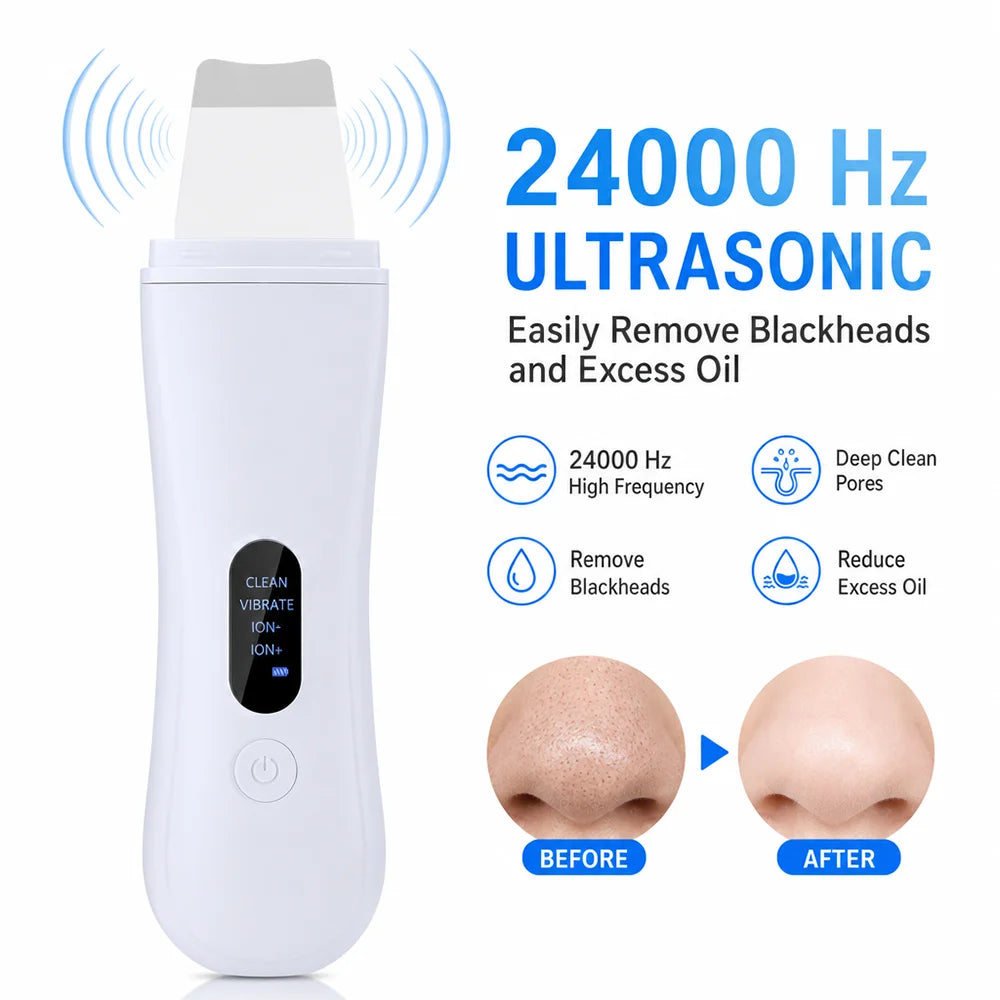 Vacuum Blackhead Remover
