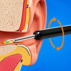 Wireless HD Ear Wax Removal Kit